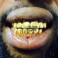 Gold Perms no grillz