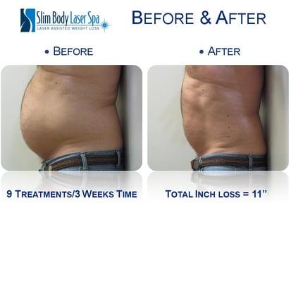 Actual Client lost +10 inches in 9 sessions or 3 weeks.