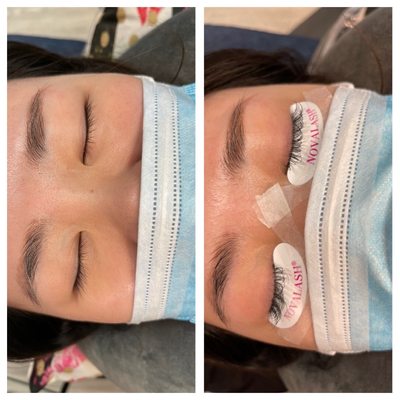 Eyelash extensions  Before and After