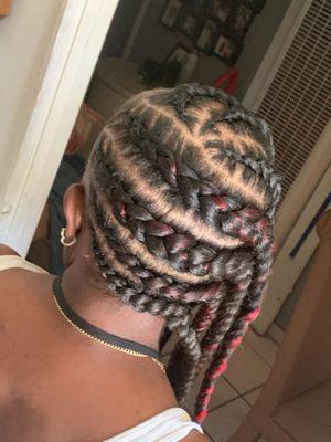 Large Lemonade braids on Alopecia