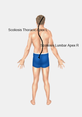 Distorted posture is evidence of nerve system interference.