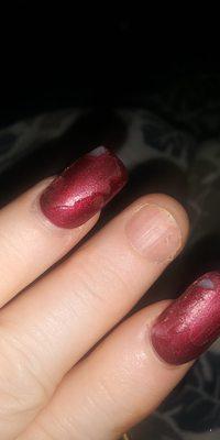 she intentionally put lots of glue.nail had to be removed it was throbbing this pic is a week later caused fungus