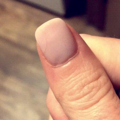 3 Nexgen nails cracked within 5 days and Envy repaired them for free. Within 7 days, 3 more cracked.