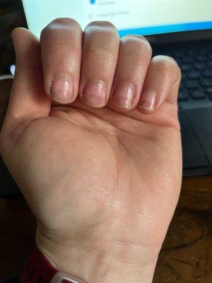 These are my nails. Trying to recover.