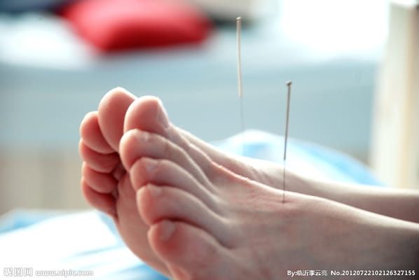 Spors Injury Acupuncture