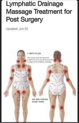 LYMPHATIC TREATMENT POST SURGERY