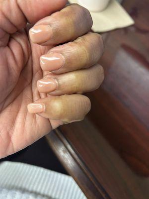 There are small bubbles and lumps under the middle nail and ring finger nails.