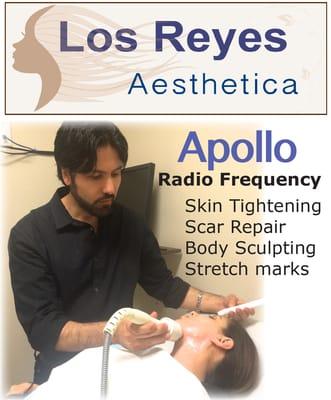 Apollo Radio Frequency body sculpting, scar, stretch mark, and wrinkle repair.