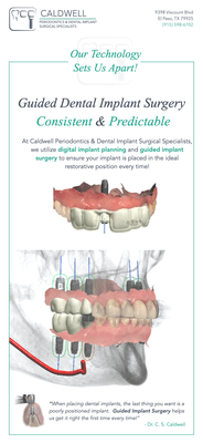 Guided Implant Surgery