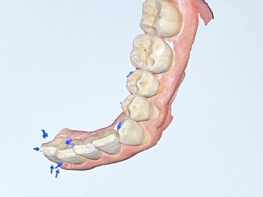 Dental scan