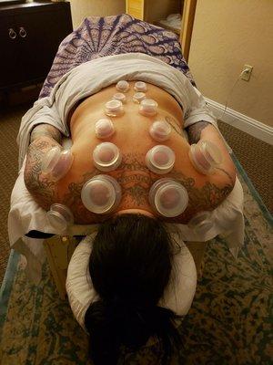 Cupping Therapy