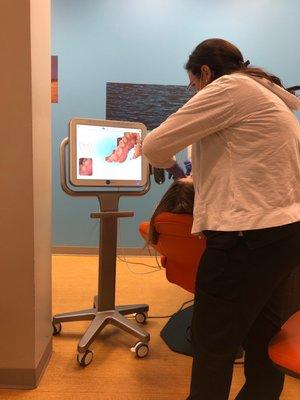 3D scanning of my daughter's mouth.