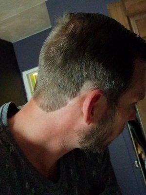 The bald spot my husband received.