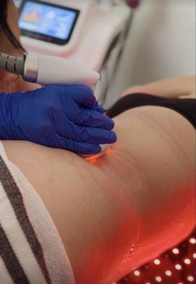 Sculpt your dream body with our cavitation magic! Limited spots for transformation!!