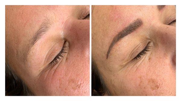 Microblading