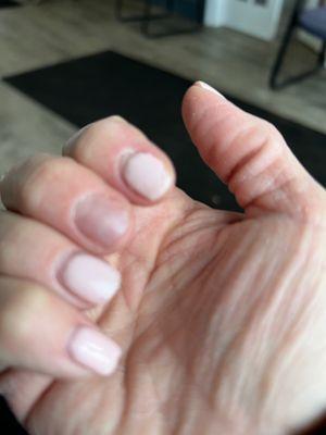 Nails that cracked and chipped after 5 days.