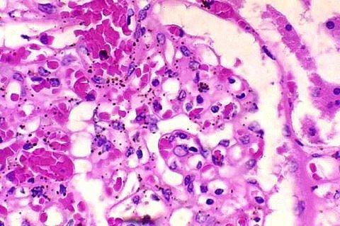 H&E Stained Sample on A Microscope