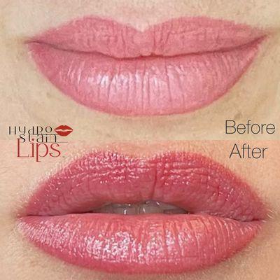 Before & after Hydrostain Lips