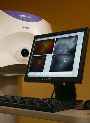 Optomap retinal imaging