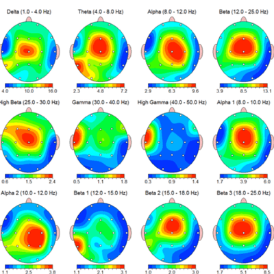 Brain maps help us understand how your brain is working. We use maps to develop custom training program to help your brain function better.