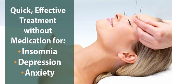 Relieve Stress with Acupuncture