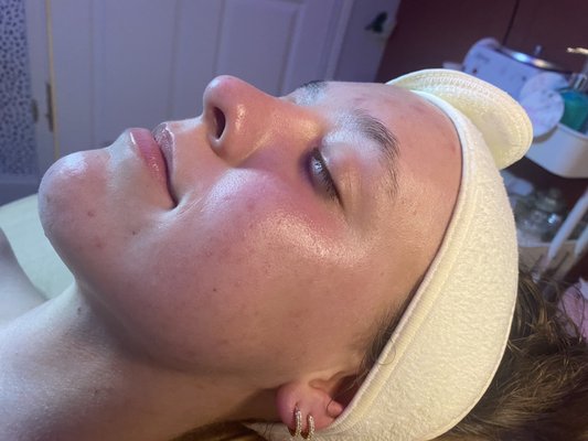 The "A New You" service! A full facial with microdermabrasion! Look at her beautiful, glowy skin!