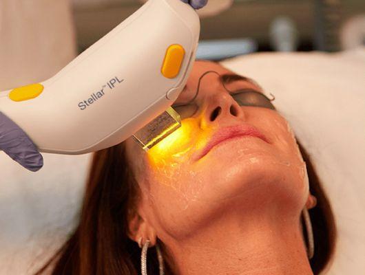 Photofacial with the Stellar M22