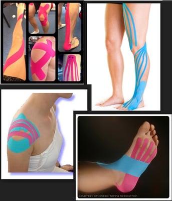 Kinesiotaping