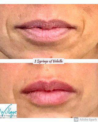 Natural beautiful Lips by Gracie, NP