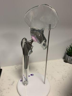 Model of a total hip replacement in the consultation room