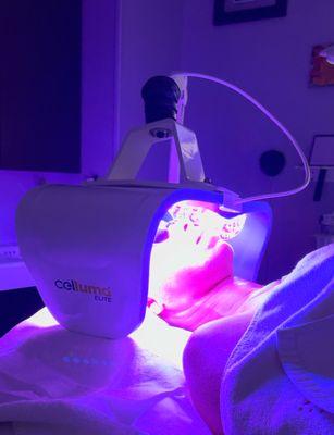 Celluma Therapy, also known as Phototherapy, uses specific wavelengths of light energy to tissue to obtain therapeutic benefits!!