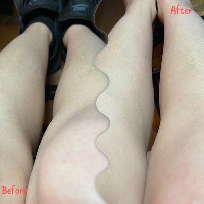 Before and after body sugaring hair removal