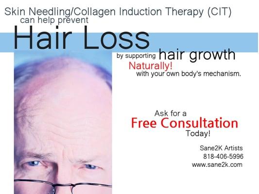 Skin Needling/Collagen Induction Therapy to prevent and slow down hair loss