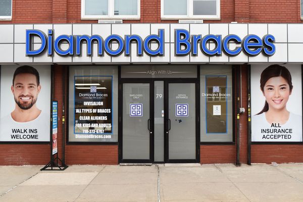 Diamond Braces