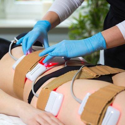 Non-Invasive Lipo