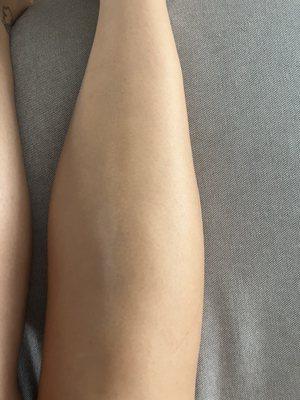 Leg after sugar wax