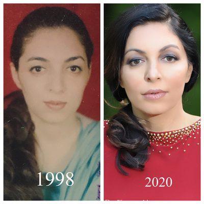 Meet Dr Din, 22 years ago and now ! Thanks to modern anti-aging