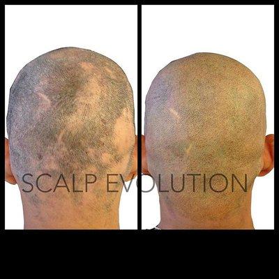 Scalp Evolution