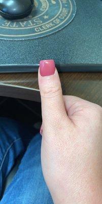 VERY crooked thumb nail