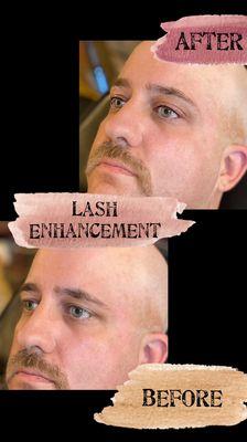 Lash Enhancement