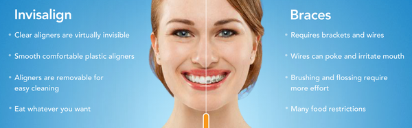 We offer Invisalign! Call us now: (732)364-5100