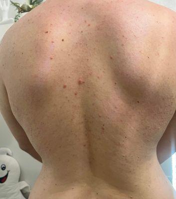 male back waxing