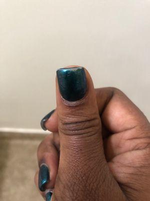 Worse nails