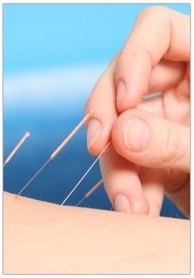 Acupuncture & Herbs