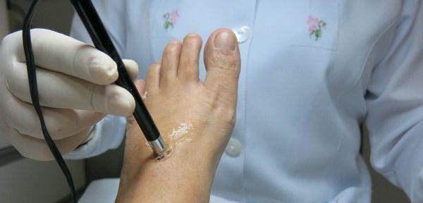 Foot treatment by foot and ankle specialist