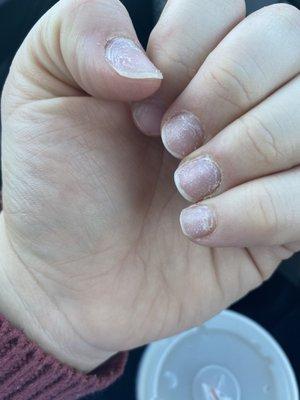 My ruined/paper thin nails after leaving today.