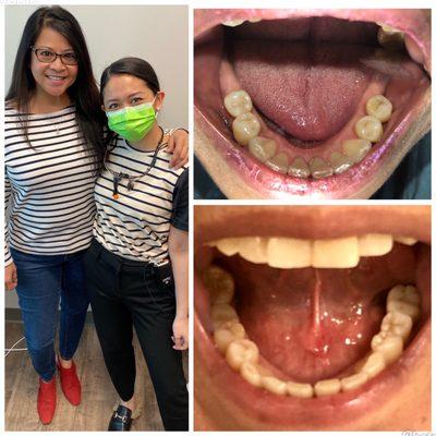 Dr.  Kara Tapangan...she's the BESTEST Dentist I've ever had!  Check out my new teeth implants.