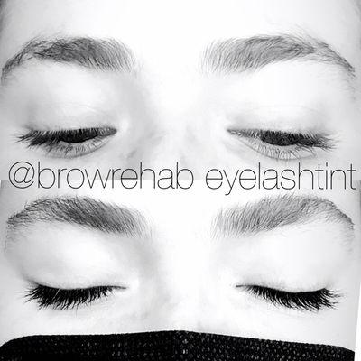 Brow Rehab