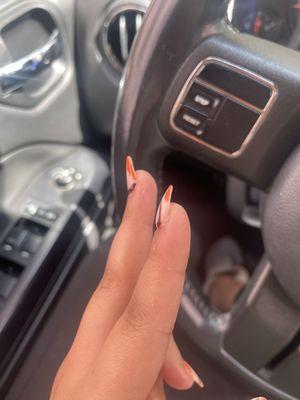 One finger nail looks straight but the other one looks bent backwards