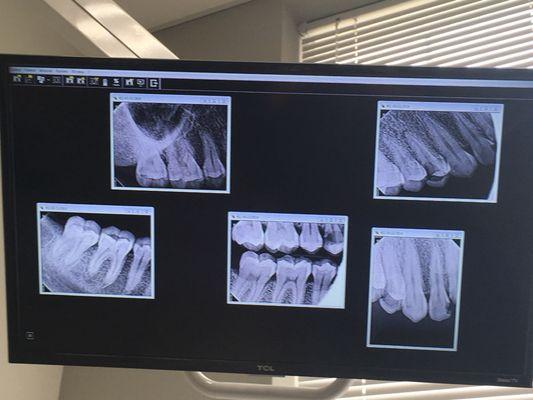 You can also view your xrays. This is mine. I'm okay sharing it.